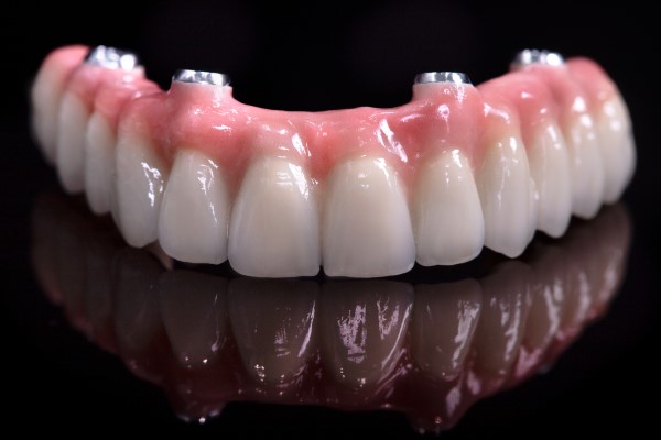 view of dentures at RTC Dental in Reston, VA for Emergency dentist Reston services.