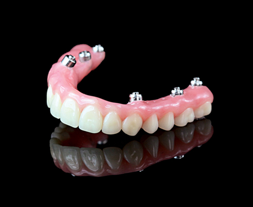 view of dentures at RTC Dental in McLean for Invisalign Reston services.