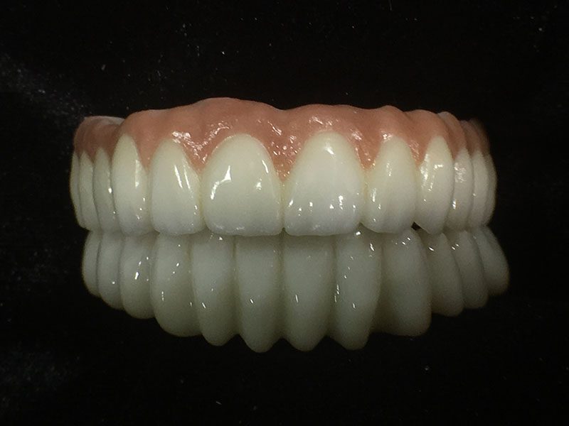 dentures at RTC Dental in Reston, VA for Emergency dentist Reston services.