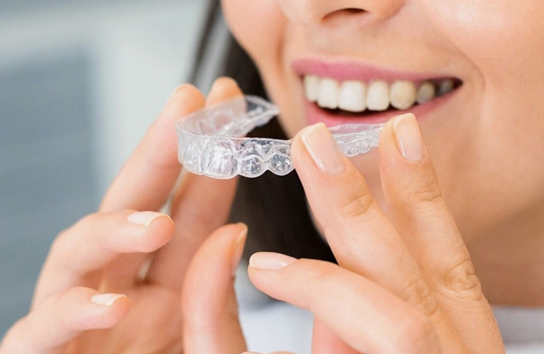 invisalign installation at RTC Dental in Reston, VA for Dentist Reston VA services.