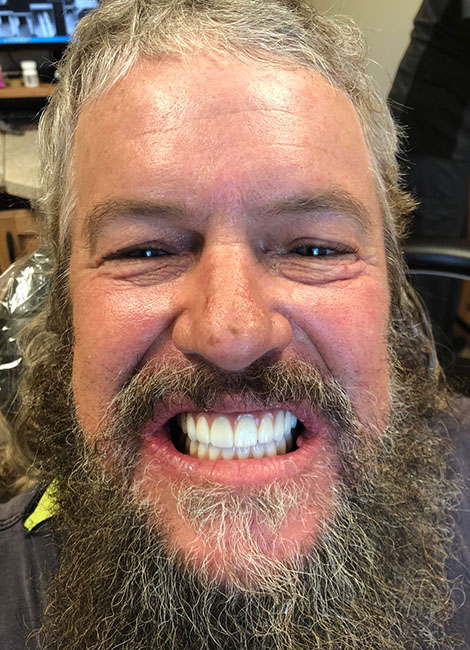 a man with a beard and a mustache  at RTC Dental in Oakton for Dental implants Reston services.