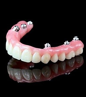 view of dentures at RTC Dental in Reston, VA for Dentist Reston VA services.