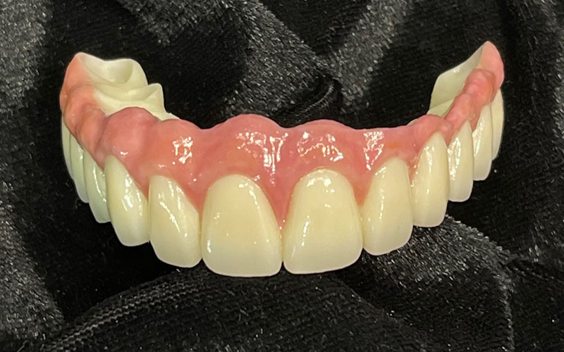 view of dentures at RTC Dental in McLean for Invisalign Reston services.