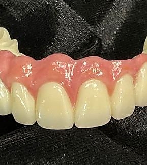 view of dentures at RTC Dental in McLean for Invisalign Reston services.