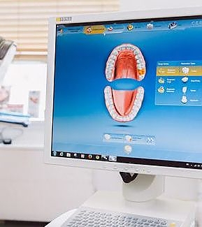 a computer screen with a cartoon character on it  at RTC Dental in Vienna for Family dentistry Reston services.